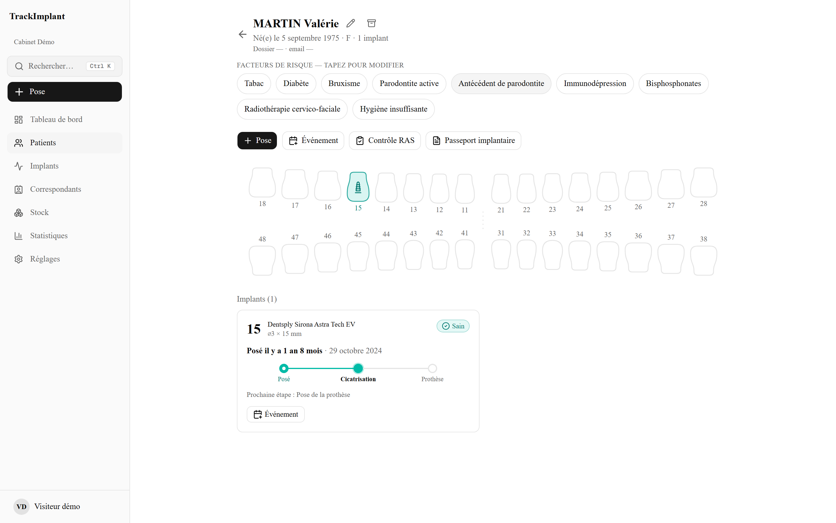Fiche patient — historique et passeport implantaire
